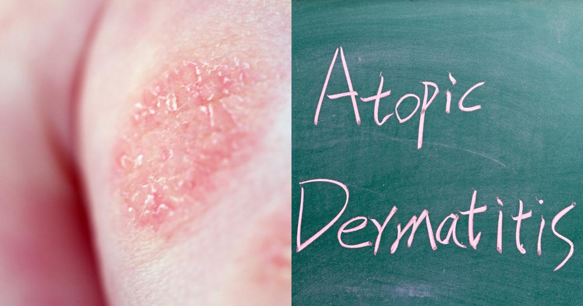 갑자기 체중이 줄어든다면 의심해야 할 병 5